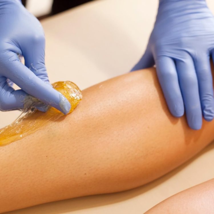 A ball of sugar being applicated to someone's leg. The person applying the sugar is wearing blue latex gloves.